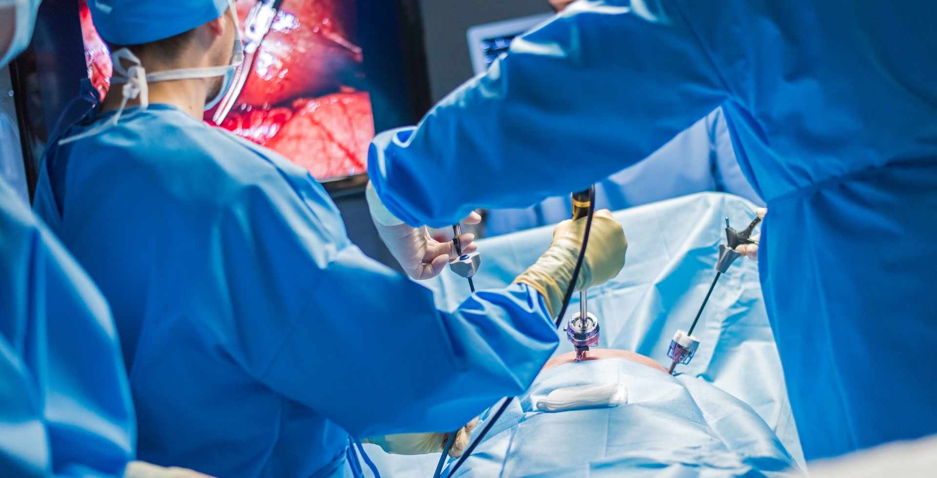 cuánto cuesta la bipartición intestinal y qué incluye el tratamiento