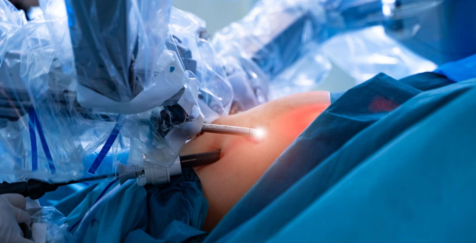 bipartición intestinal riesgos recuperación y resultados reales