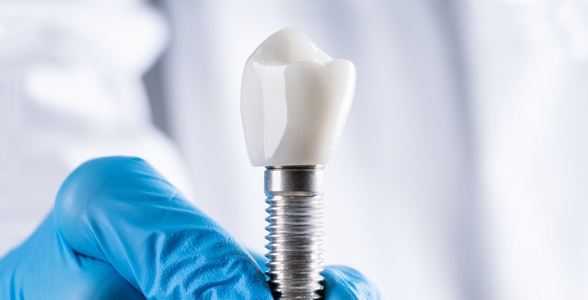 desgaste dental causas y tratamiento con rehabilitacion oral