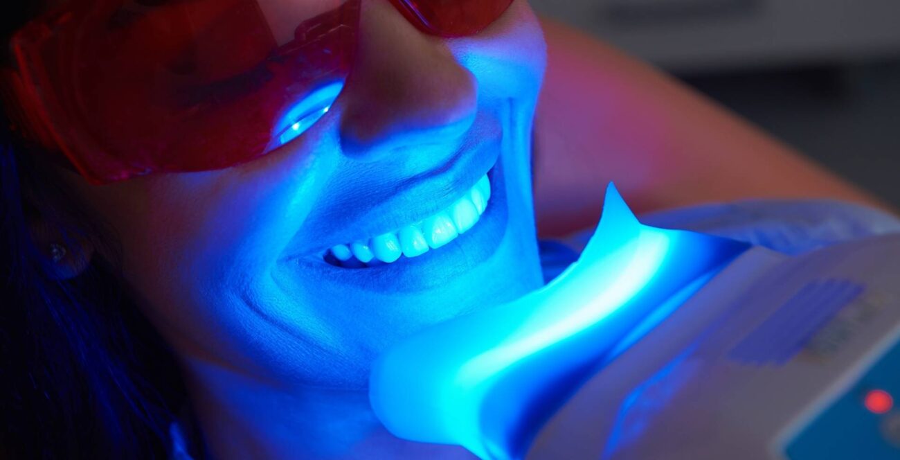 Sesión de blanqueamiento dental en consulta odontológica en Samborondón