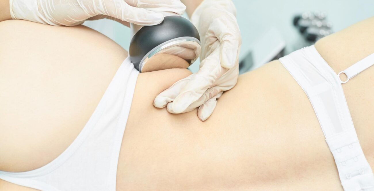 Paciente usando faja compresiva durante recuperación de lipoescultura